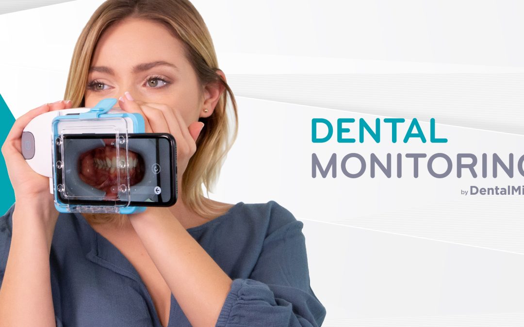 Dental Monitoring