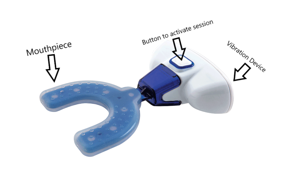 VPro+: Device that can help improve your orthodontic treatment!